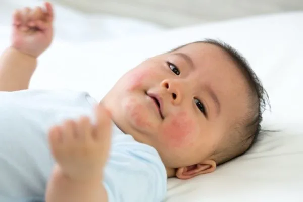 My baby has red spots on their face: what should I do?