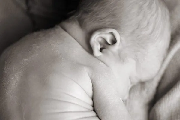 Is Lanugo Normal in Newborns?